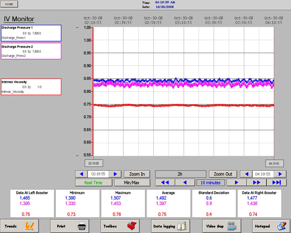 PTi's real-time IV Monitoring System